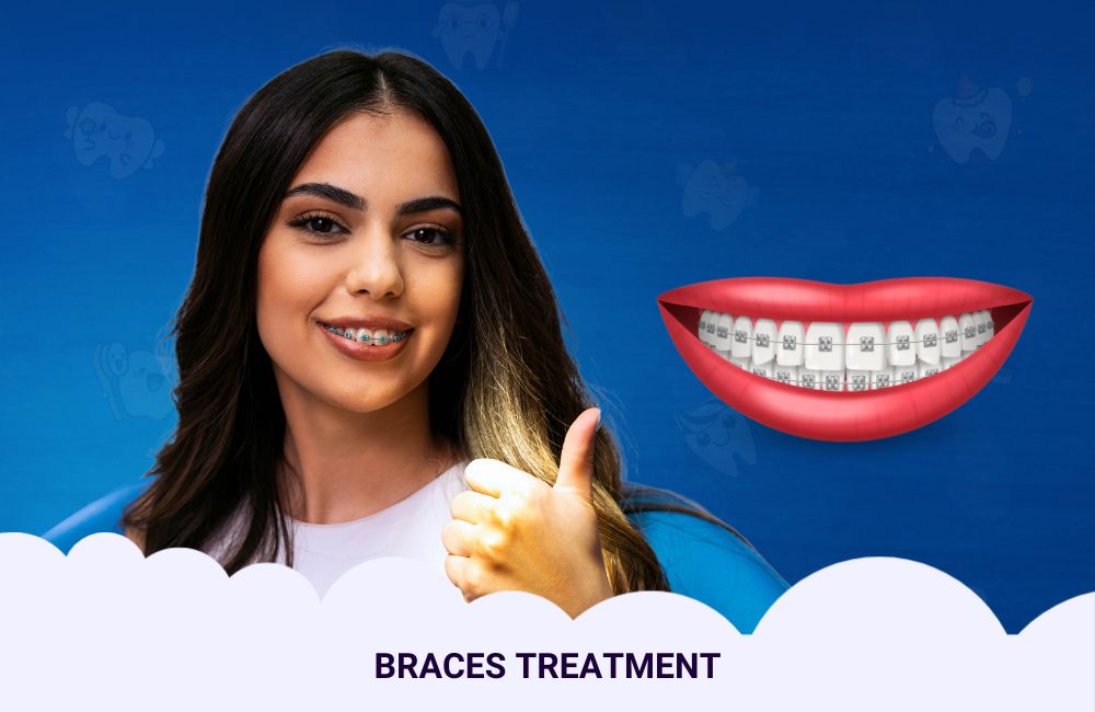 Braces Treatment In Ghodbunder Road