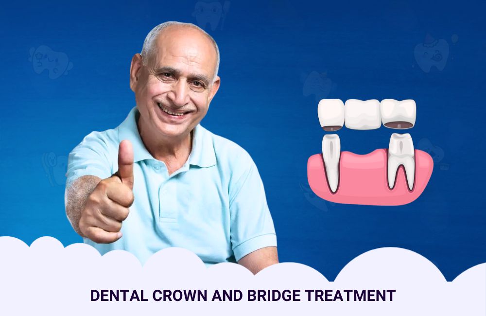 Dental Crown & Bridge In Ghodbunder Road