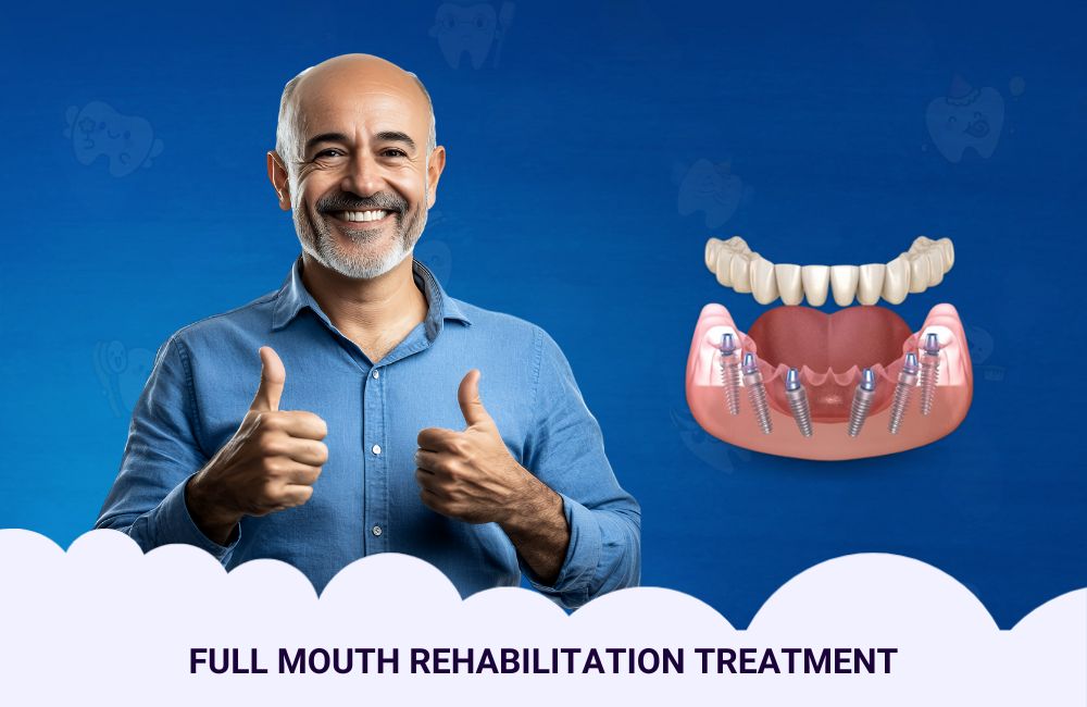 Full Mouth Rehabilitation Treatment In Ghodbunder Road