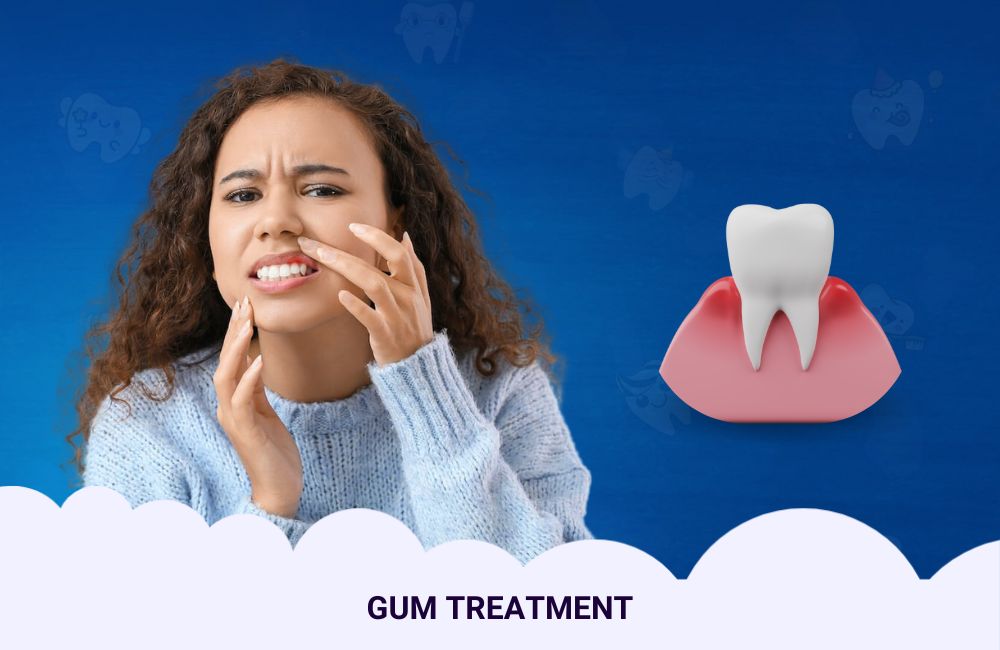 Gum Treatment In Ghodbunder Road
