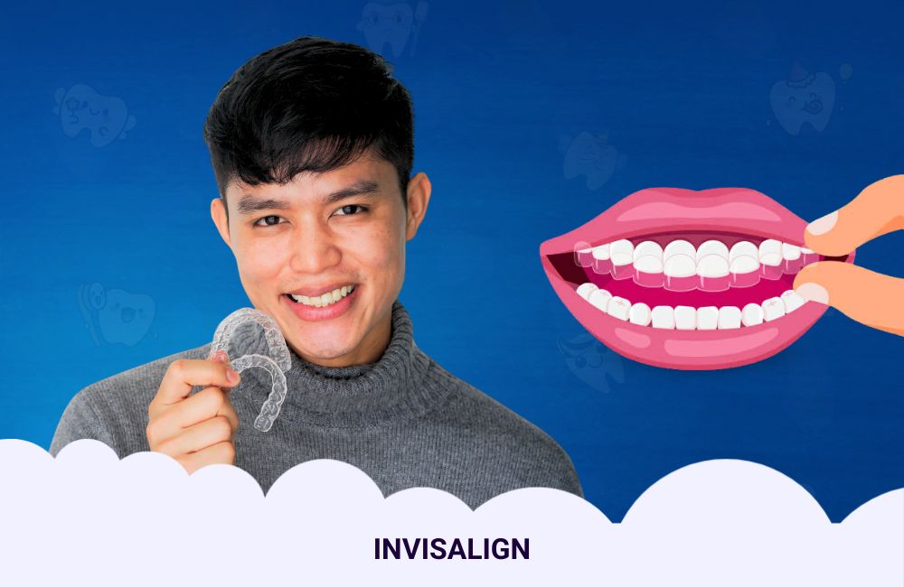 Invisalign Treatment In Ghodbunder Road: A Clear Path To A Perfect Smile