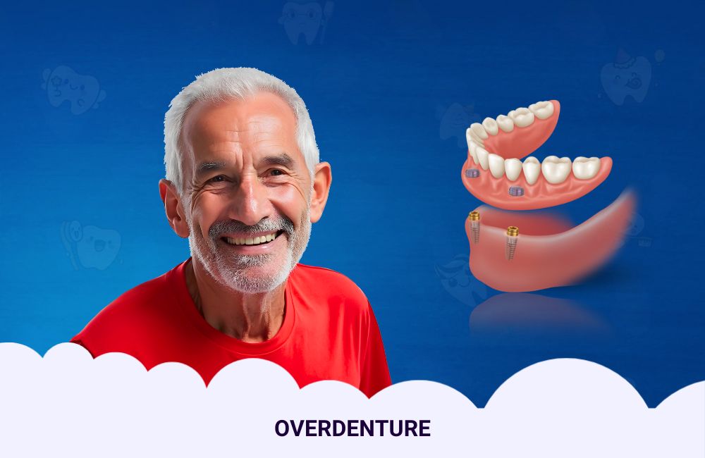 Overdenture In Ghodbunder Road