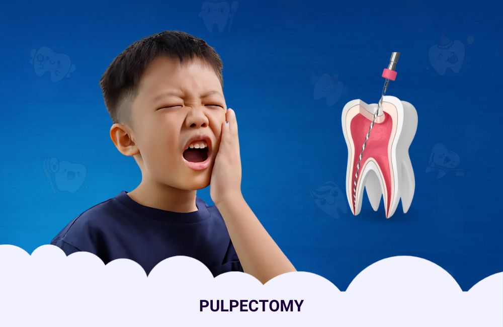 Pulpectomy For Kids In Ghodbunder Road