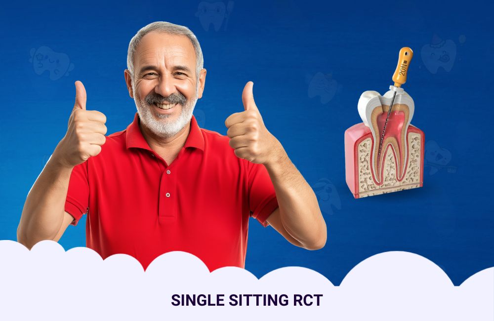 Single Sitting Root Canal Treatment In Ghodbunder Road
