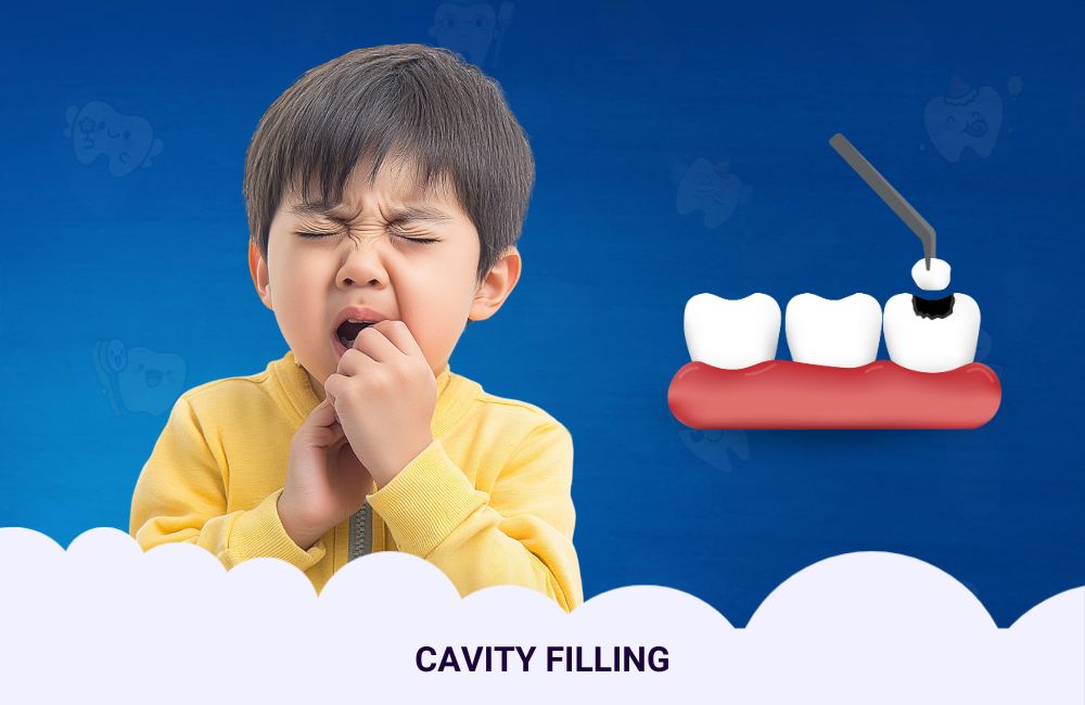 Tooth-colored Fillings In Ghodbunder Road