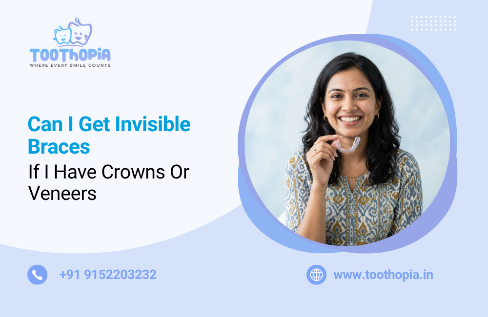 Can I Get Invisible Braces If I Have Crowns or Veneers?