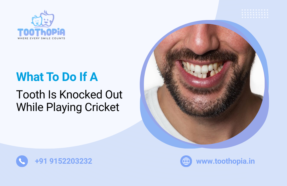 What To Do If A Tooth Is Knocked Out While Playing Cricket